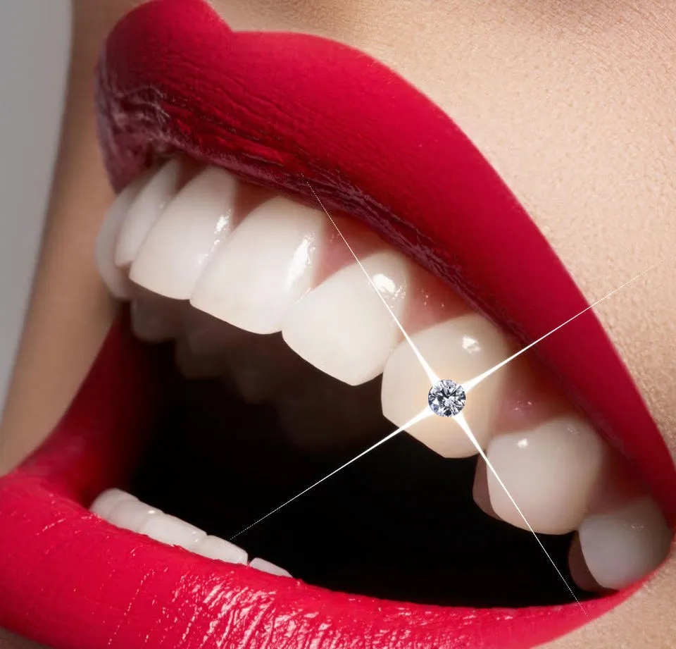 Tooth Gems