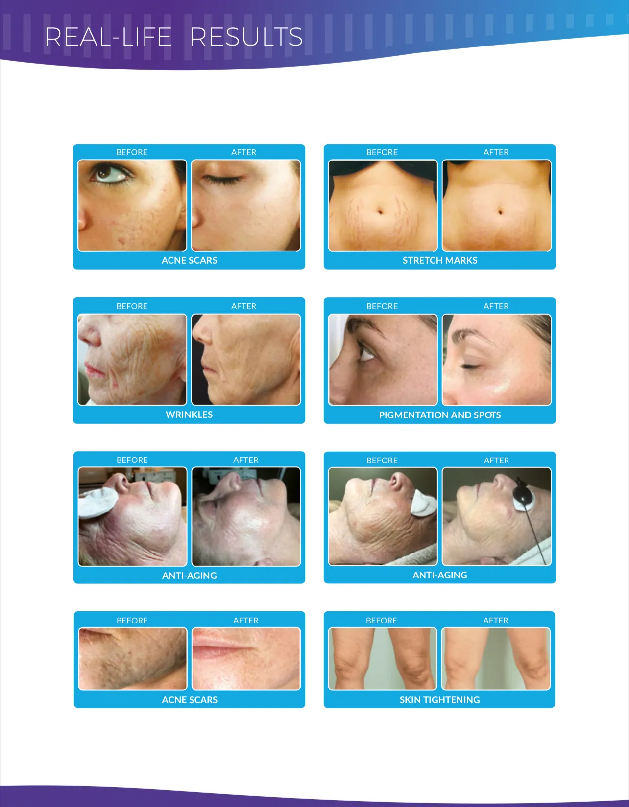 Facials